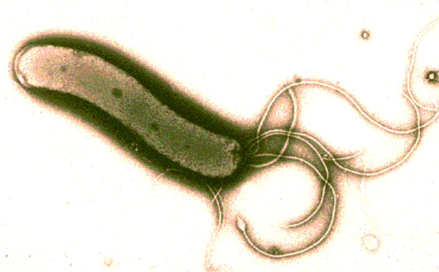 Deinococcus - microbewiki